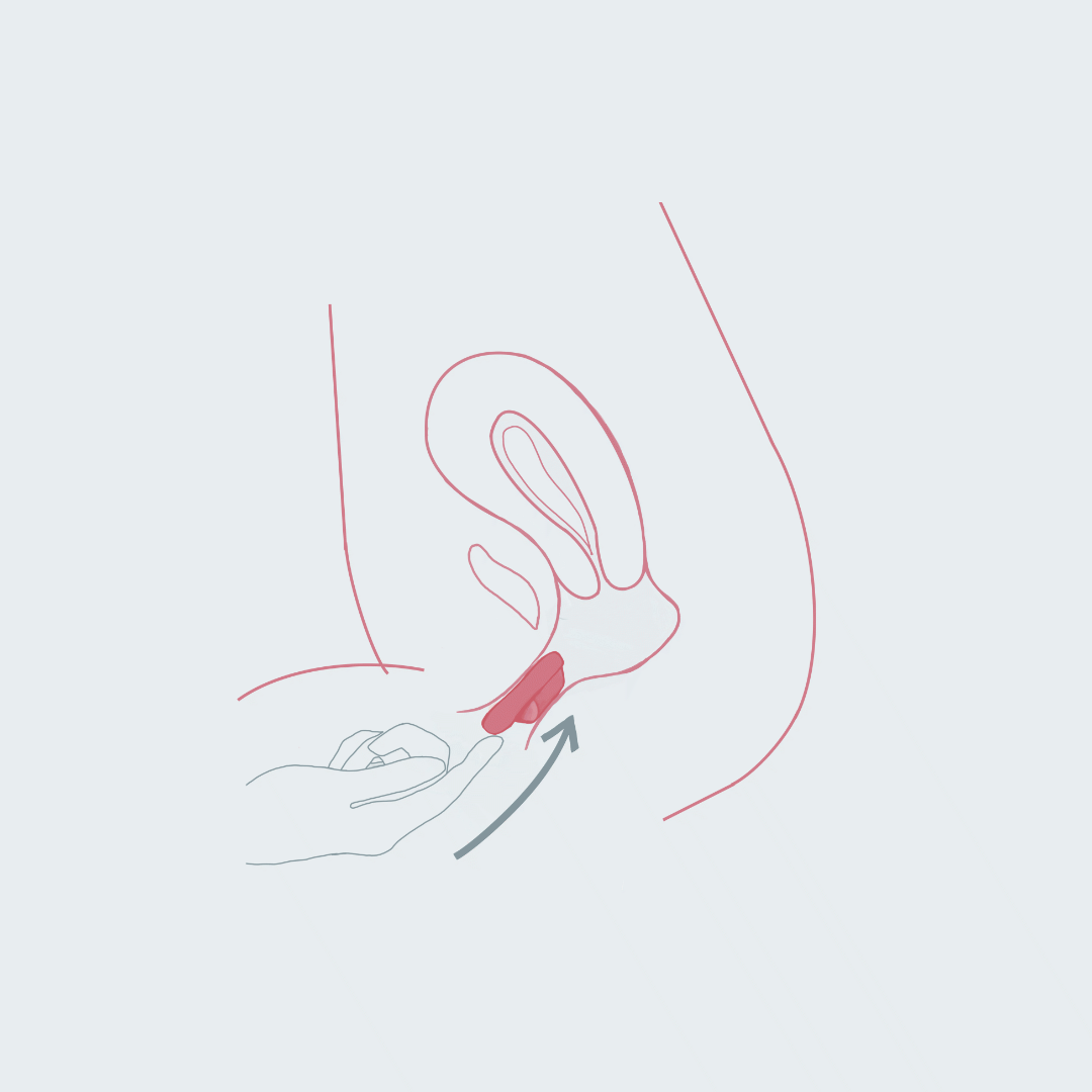 Menstruations-Disc anwenden: Dein step-by-step Guide zum Einführen & Entfernen